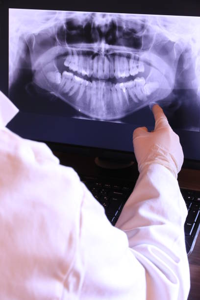 Best Emergency Dentist for Knocked-Out Tooth in Reading, PA