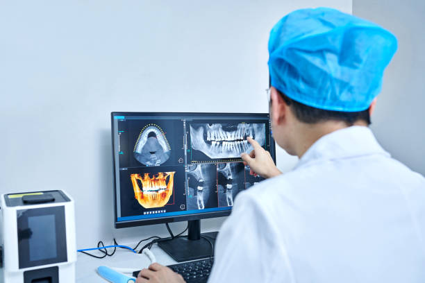 Best Emergency Dental Extractions in Reading, PA
